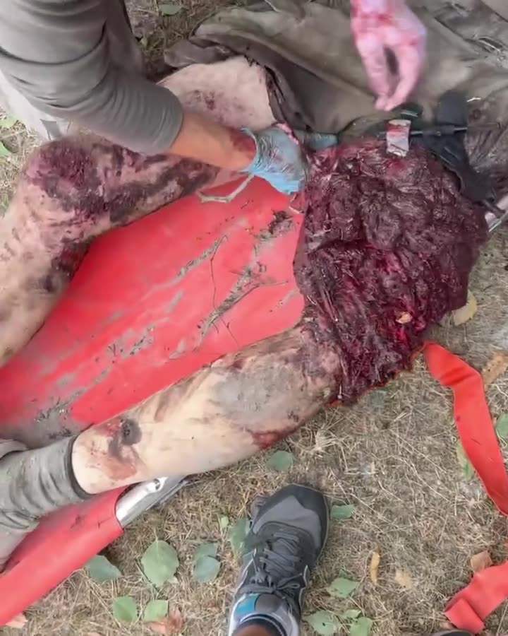Превью видео